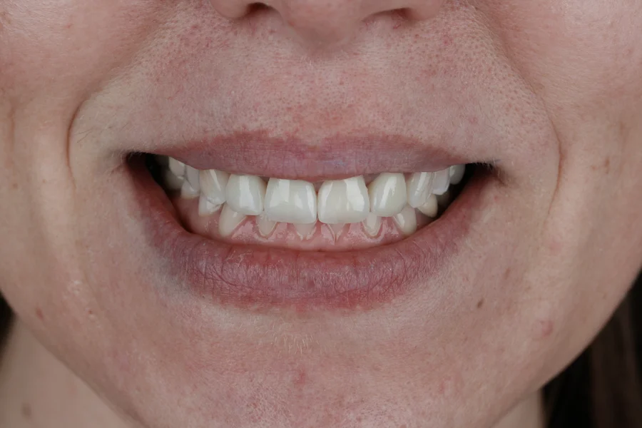 dentista tarragona estetica dental